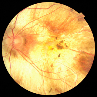 Jeff-left-eye-square