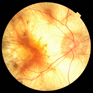 Jeff-right-eye-square-2