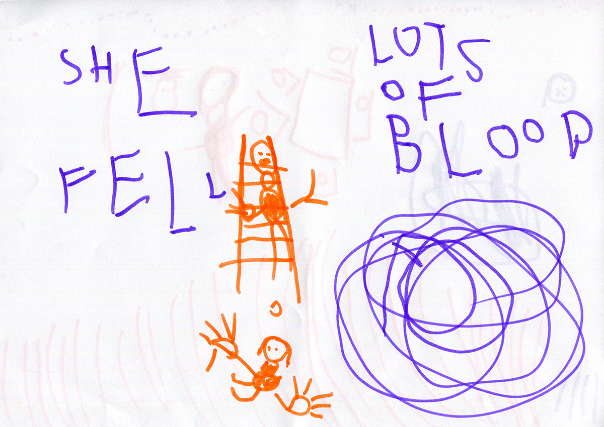 This is an action image of the girl falling off the ladder; the tooth falls out in the time-lapse