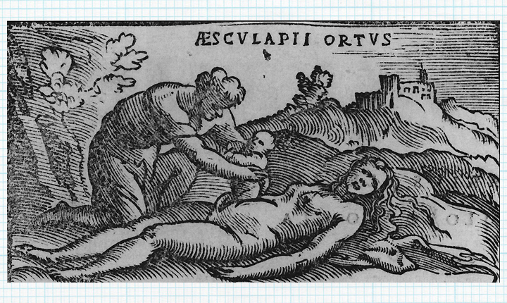 A 1549 woodcut of a cesarean-like procedure in Greek mythology.