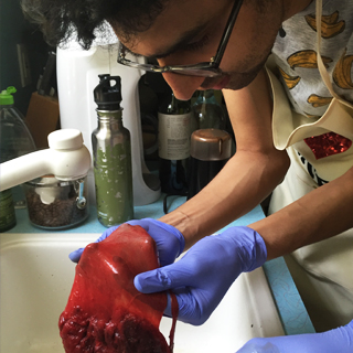 Latif-placenta-square-2